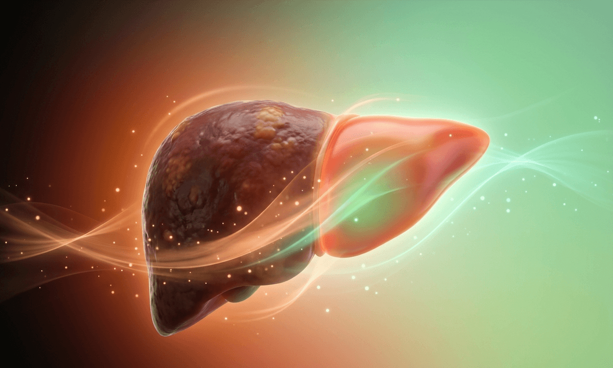 zdravá a nezdravá játra - ilustrace